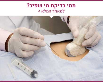 דיקור מי שפיר