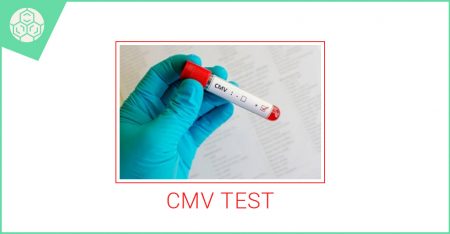 cmv